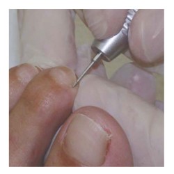 BUR ONY-clean 406L-RS-012