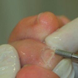 Diamond grinding frezy  854-033